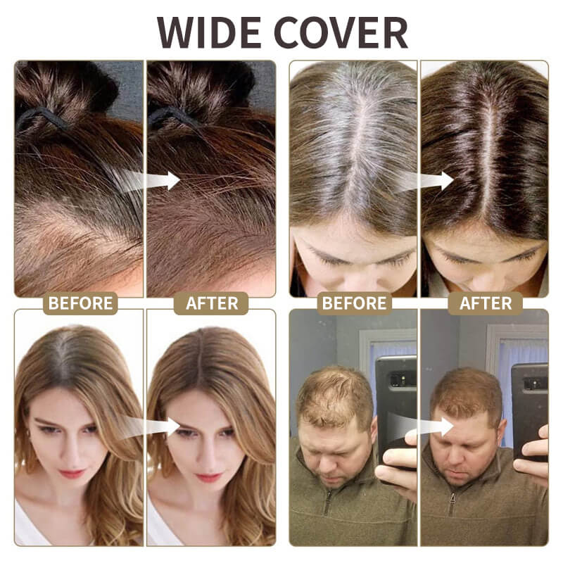 🎀Kjøp 1 få 1 gratis🎀Oppgrader Magic Root Cover Up🩷