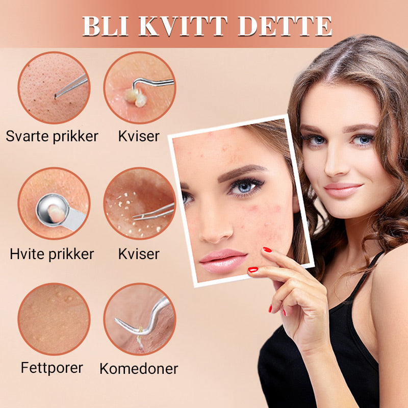 💓💥Hudorm fjerner kvise avtrekkerverktøysett