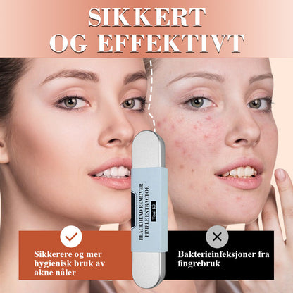 💓💥Hudorm fjerner kvise avtrekkerverktøysett
